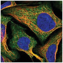 DUS2L Rabbit anti-Human, Polyclonal Antibody, Abnova 100 &mu;L | Buy Online | Abnova Corporation | Fisher Scientific