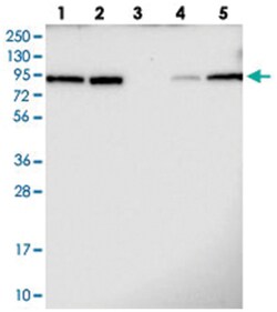TBL3, Rabbit, Polyclonal Antibody, Abnova 100&mu;L; Unlabeled:Antibodies,