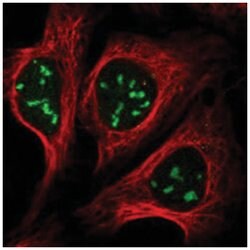 TBL3, Rabbit, Polyclonal Antibody, Abnova 100&mu;L; Unlabeled:Antibodies,
