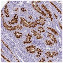 SLC7A9 Rabbit anti-Human, Polyclonal Antibody, Abnova 100 &mu;L | Buy Online | Abnova Corporation | Fisher Scientific
