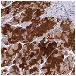 VKORC1 Rabbit anti-Human, Polyclonal Antibody, Abnova 100 &mu;L | Buy Online | Abnova Corporation | Fisher Scientific