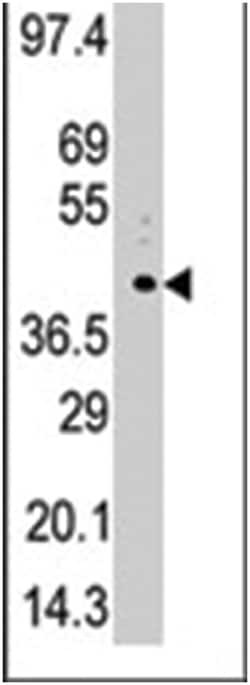 PHKG1, Rabbit, Polyclonal Antibody, Abnova 400 &mu;L | Buy Online | Abnova Corporation | Fisher Scientific