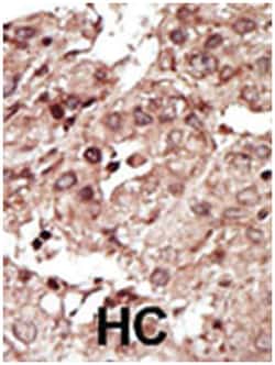 PHKG1, Rabbit, Polyclonal Antibody, Abnova 400 &mu;L | Buy Online | Abnova Corporation | Fisher Scientific