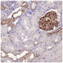 RGL3 Rabbit anti-Human, Polyclonal Antibody, Abnova 100&mu;L; Unlabeled:Antibodies,