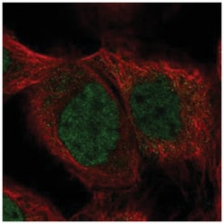 SHQ1 Rabbit anti-Human, Polyclonal Antibody, Abnova 100 &mu;L | Buy Online | Abnova Corporation | Fisher Scientific