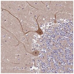 SMG6, Rabbit, Polyclonal Antibody, Abnova 100 &mu;L | Buy Online | Abnova Corporation | Fisher Scientific