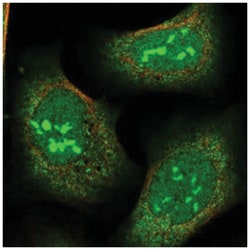 SMG6, Rabbit, Polyclonal Antibody, Abnova 100 &mu;L | Buy Online | Abnova Corporation | Fisher Scientific