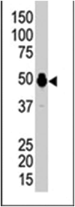 PHKG2, Rabbit, Polyclonal Antibody, Abnova 400 &mu;L | Buy Online | Abnova Corporation | Fisher Scientific