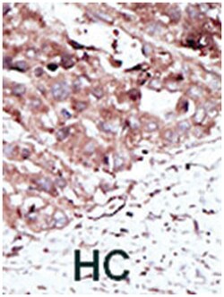 PHKG2, Rabbit, Polyclonal Antibody, Abnova 400 &mu;L | Buy Online | Abnova Corporation | Fisher Scientific