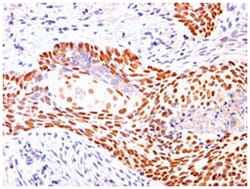 TP63, Rabbit, Polyclonal Antibody, Abnova 100 &mu;g | Buy Online | Abnova Corporation | Fisher Scientific