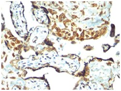 TIMP3 Rabbit anti-Bovine, Dog, Horse, Human, Polyclonal Antibody, Abnova