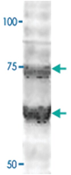 WLS, Chicken, Polyclonal Antibody, Abnova 100 &mu;L | Buy Online | Abnova Corporation | Fisher Scientific