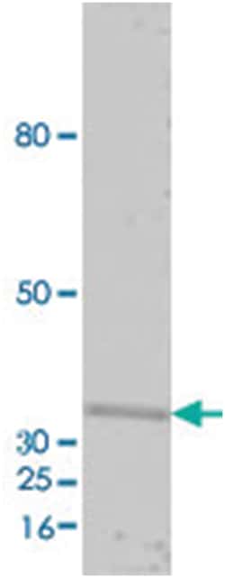 GFP, Chicken, Polyclonal Antibody, Abnova 100&mu;L; Unlabeled:Antistoffer