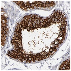 KIAA1210, Rabbit, Polyclonal Antibody, Abnova 100 &mu;L | Buy Online | Abnova Corporation | Fisher Scientific