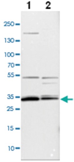 APOOL Rabbit anti-Human, Polyclonal Antibody, Abnova 100&mu;L; Unlabeled:Antibodies,