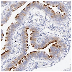 WDR65, Rabbit, Polyclonal Antibody, Abnova 100&mu;L; Unlabeled:Antibodies,