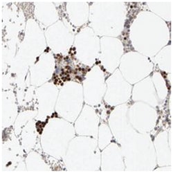 ZNF285, Rabbit, Polyclonal Antibody, Abnova 100 &mu;L | Buy Online | Abnova Corporation | Fisher Scientific