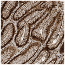 C1orf170, Rabbit, Polyclonal Antibody, Abnova 100&mu;L; Unlabeled:Antibodies,