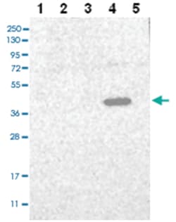 C3orf33, Rabbit, Polyclonal Antibody, Abnova 100 &mu;L | Buy Online | Abnova Corporation | Fisher Scientific