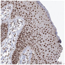 C3orf33, Rabbit, Polyclonal Antibody, Abnova 100 &mu;L | Buy Online | Abnova Corporation | Fisher Scientific