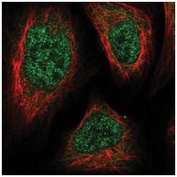 C3orf33, Rabbit, Polyclonal Antibody, Abnova 100 &mu;L | Buy Online | Abnova Corporation | Fisher Scientific