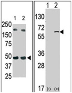 SPHK1 Rabbit anti-Human, Polyclonal Antibody, Abnova 400 &mu;L | Buy Online | Abnova Corporation | Fisher Scientific