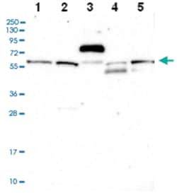 C15orf44, Rabbit, Polyclonal Antibody, Abnova 100 &mu;L | Buy Online | Abnova Corporation | Fisher Scientific