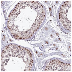 C15orf44, Rabbit, Polyclonal Antibody, Abnova 100 &mu;L | Buy Online | Abnova Corporation | Fisher Scientific