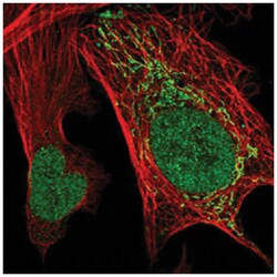 C15orf44, Rabbit, Polyclonal Antibody, Abnova 100 &mu;L | Buy Online | Abnova Corporation | Fisher Scientific