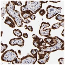 MAGEA10 Rabbit anti-Human, Polyclonal Antibody, Abnova 100 &mu;L | Buy Online | Abnova Corporation | Fisher Scientific