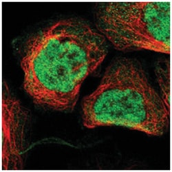 ZNF512B Rabbit anti-Human, Polyclonal Antibody, Abnova 100 &mu;L | Buy Online | Abnova Corporation | Fisher Scientific