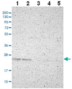 PDDC1, Rabbit, Polyclonal Antibody, Abnova 100 &mu;L | Buy Online | Abnova Corporation | Fisher Scientific