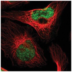 PDDC1, Rabbit, Polyclonal Antibody, Abnova 100 &mu;L | Buy Online | Abnova Corporation | Fisher Scientific