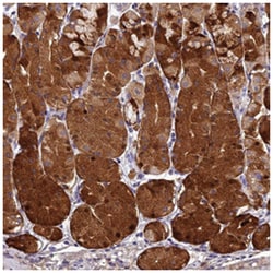 ST3GAL6 Rabbit anti-Human, Polyclonal Antibody, Abnova 100&mu;L; Unlabeled:Antibodies,