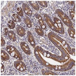 LSM5, Rabbit, Polyclonal Antibody, Abnova 100&mu;L; Unlabeled:Antibodies,