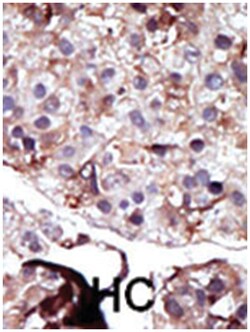 SPHK2 Rabbit anti-Human, Polyclonal Antibody, Abnova 400 &mu;L | Buy Online | Abnova Corporation | Fisher Scientific