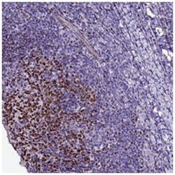 BCL7A, Rabbit, Polyclonal Antibody, Abnova 100 &mu;L | Buy Online | Abnova Corporation | Fisher Scientific