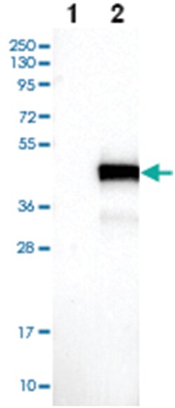 BCL7A, Rabbit, Polyclonal Antibody, Abnova 100 &mu;L | Buy Online | Abnova Corporation | Fisher Scientific
