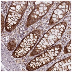 CHCHD2 Rabbit anti-Human, Polyclonal Antibody, Abnova 100 &mu;L | Buy Online | Abnova Corporation | Fisher Scientific