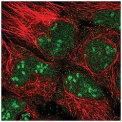 ATPBD4, Rabbit, Polyclonal Antibody, Abnova 100 &mu;L | Buy Online | Abnova Corporation | Fisher Scientific