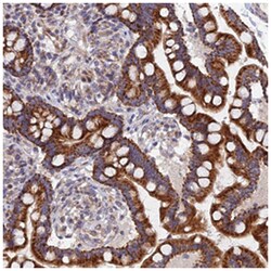 ECSIT Rabbit anti-Human, Polyclonal Antibody, Abnova 100&mu;L; Unlabeled:Antibodies,