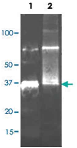 Uricase, Goat, Polyclonal Antibody, Abnova 100&mu;g; Unlabeled:Antibodies,