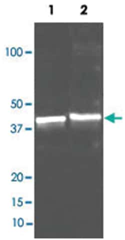 Sarcosine Oxidase, Goat, Polyclonal Antibody, Abnova 100 &mu;g | Buy Online | Abnova Corporation | Fisher Scientific