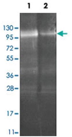 SNF4 (Candida), Goat, Polyclonal Antibody, Abnova 100&mu;g; Unlabeled:Anticuerpos