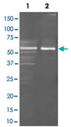 choD (Microorganism), Goat, Polyclonal Antibody, Abnova 100&mu;g; Unlabeled:Antibodies,