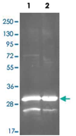 gdh, Goat, Polyclonal Antibody, Abnova 100 &mu;g | Buy Online | Abnova | Fisher Scientific