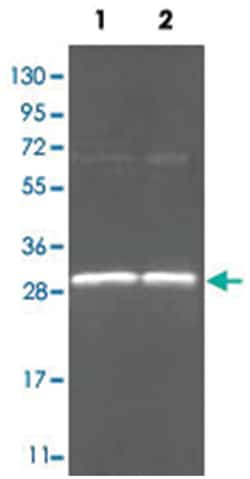 N-Acylmannosamine-1-Dehydrogenase (NAM-DH) (Pseudomonas), Goat, Polyclonal Antibody, Abnova 100 &mu;g | Buy Online | Abnova Corporation | Fisher Scientific