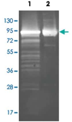 LAF_0025 (Maltose Phosphorylase (E. coli)), Goat, Polyclonal Antibody, Abnova 100 &mu;g | Buy Online | Abnova Corporation | Fisher Scientific