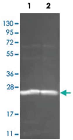 pgmB (Lactococcus lactis), Goat, Polyclonal Antibody, Abnova 100 &mu;g | Buy Online | Abnova Corporation | Fisher Scientific