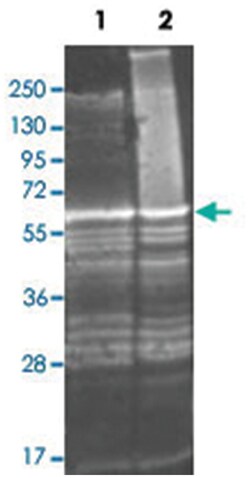 glnA, Goat, Polyclonal Antibody, Abnova 100 &mu;g | Buy Online | Abnova Corporation | Fisher Scientific